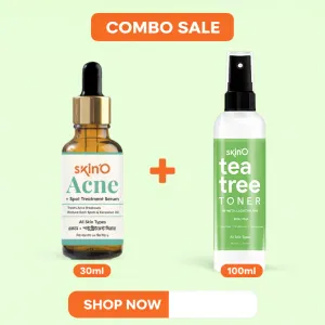 Skino Acne + Spot Treatment Serum 30ml and Skino Tea Tree Toner With (Light AHA,BHA,PHA) 100ml