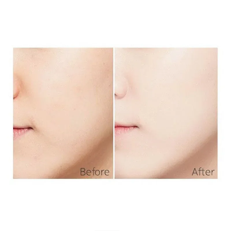 Close-up of a face showing smoother skin in the after comparison.