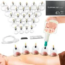 Cupping therapy set with plastic cups applied to a person's back and a hand pump device.